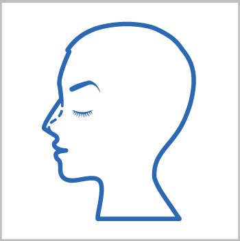 como es la cirugia de nariz o rinoplastia