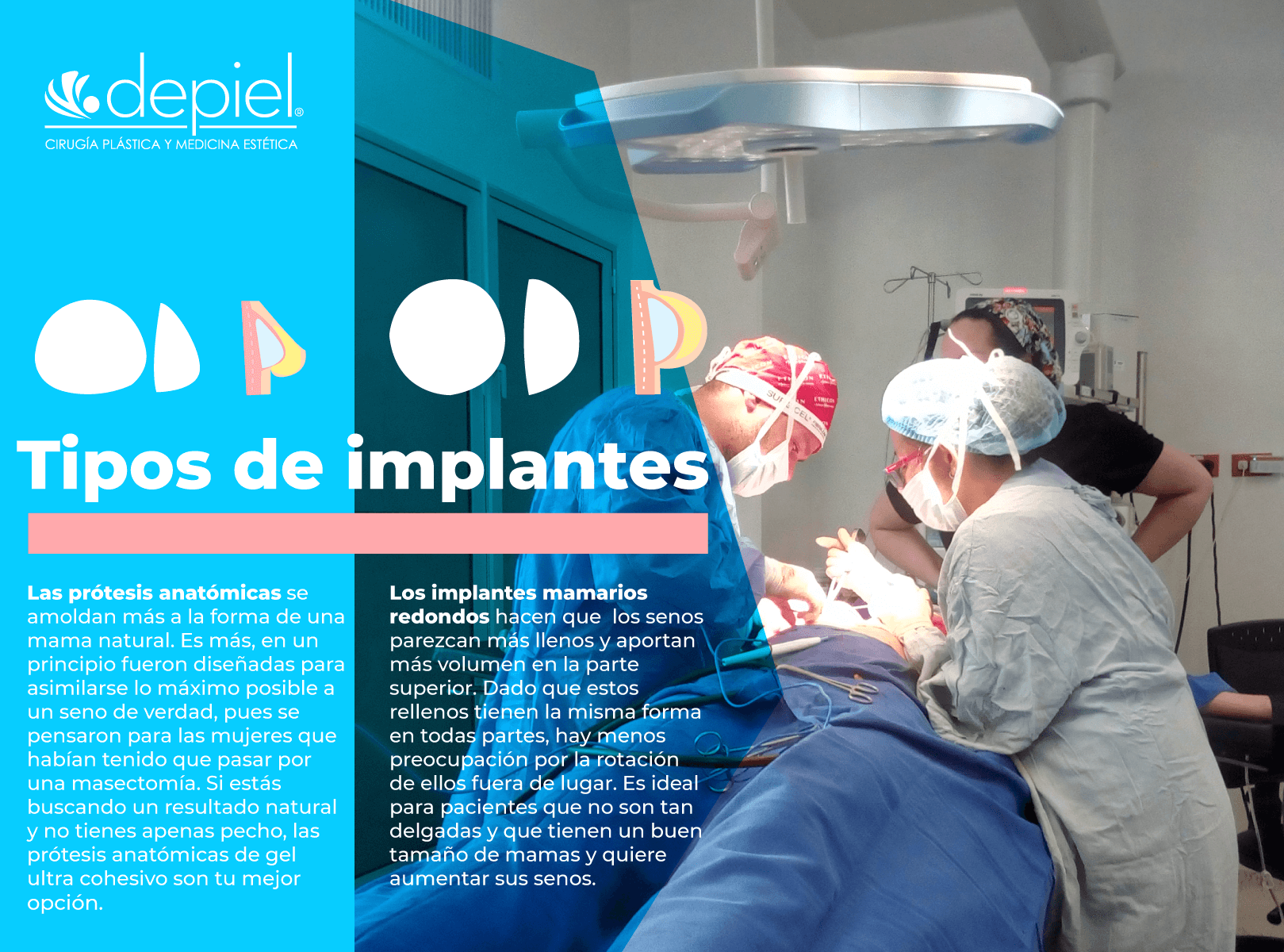 tipos de implantes