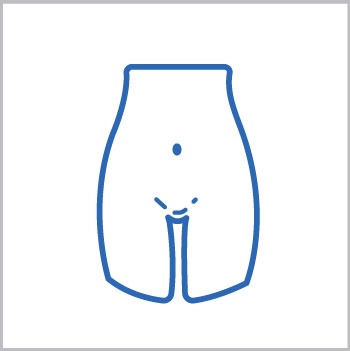 Vaginoplastia o estrachamiento vaginal