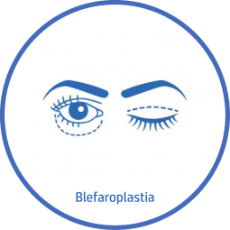 Cirugía plastica Facial blefaroplastia