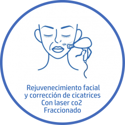 Tratamiento estetico Facial correcion de cicatrices