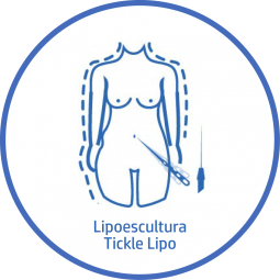 Cirugía Corporal Lipoescultura tickle lipo