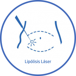 Cirugía plastica Corporal lipolisis laser